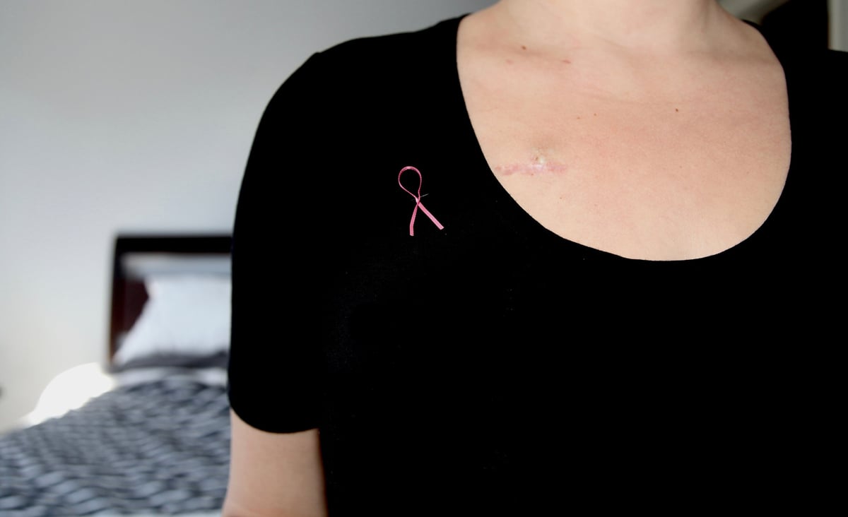 Close view of the chest and shoulder area, representing areola restoration treatment